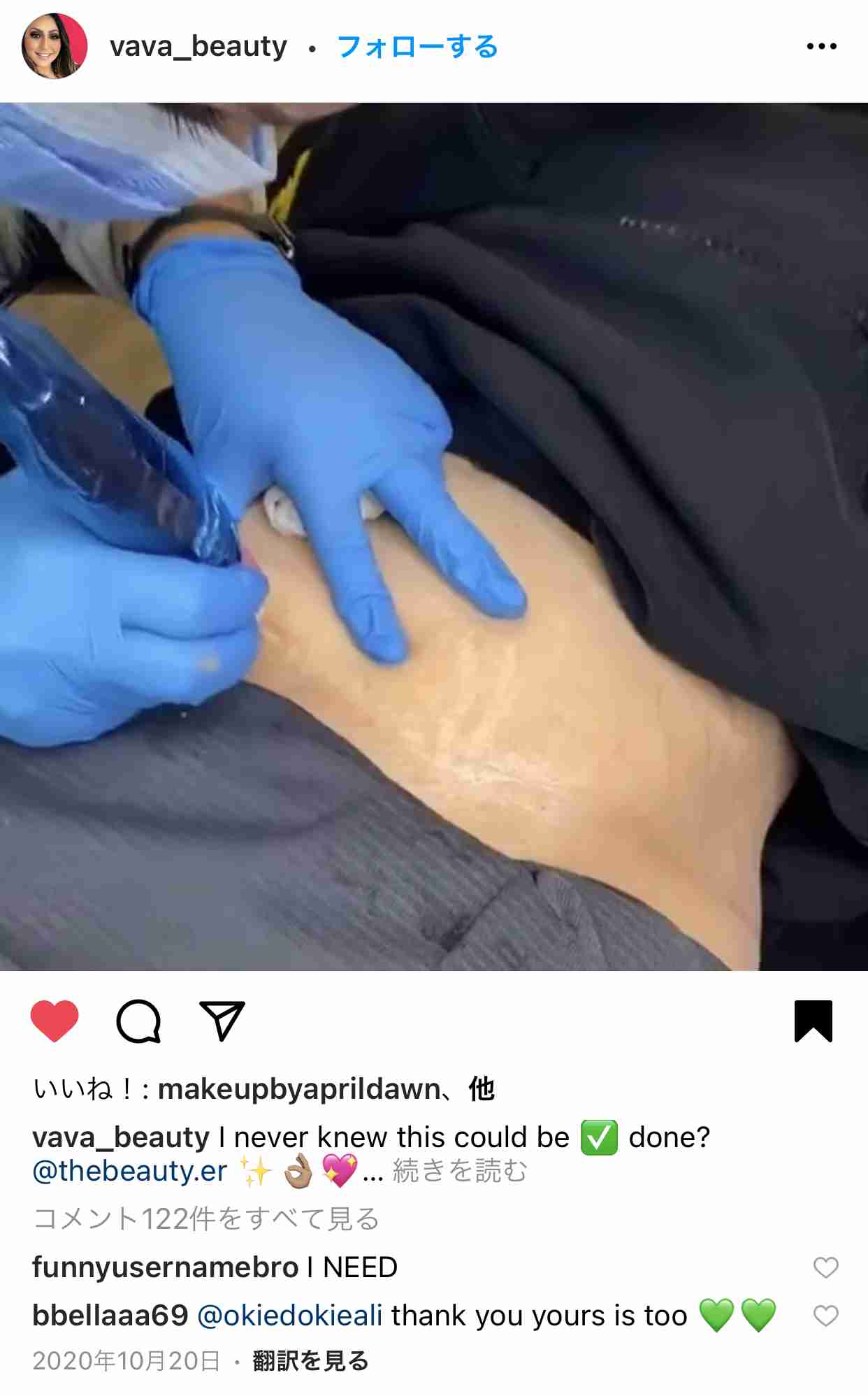 【アドバイス下さい】妊娠線⚠️