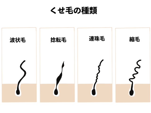 頭皮にトゲが生える人