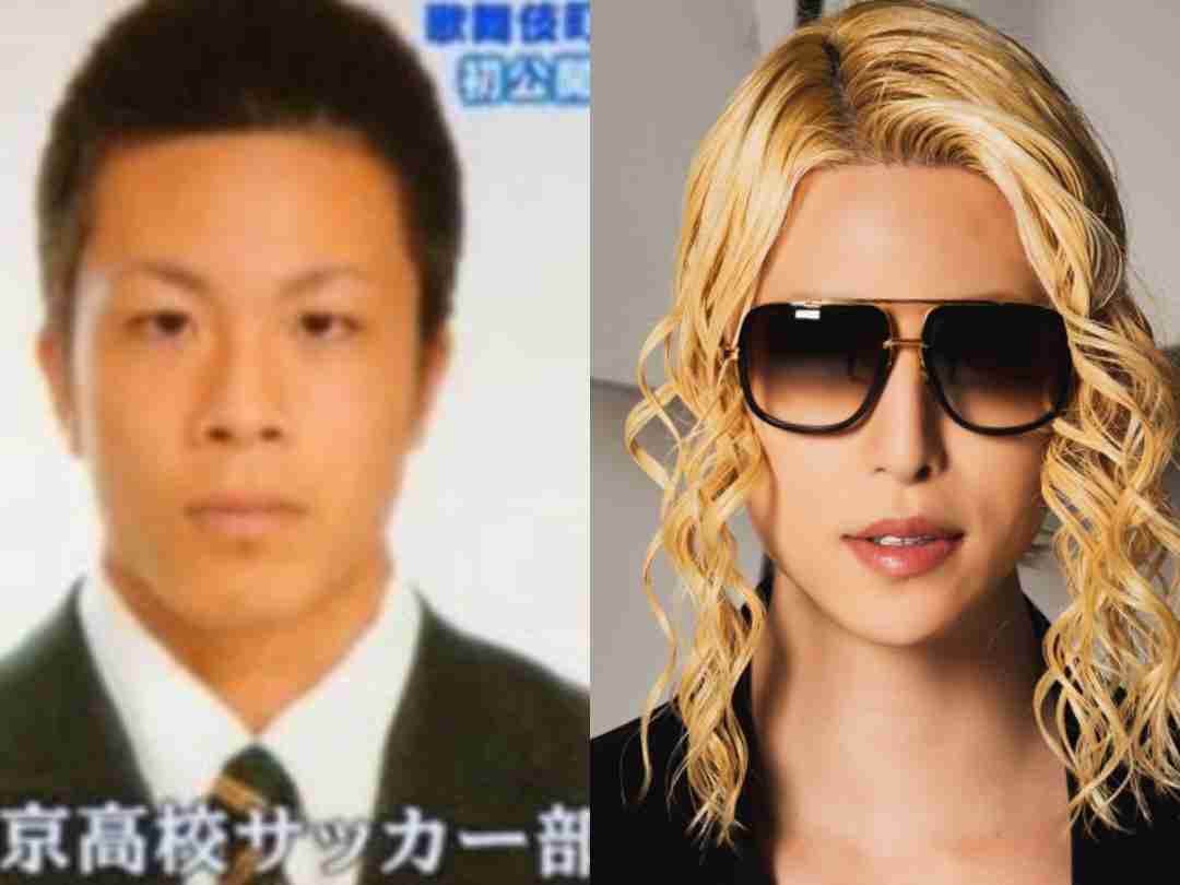 彼氏や旦那に整形を告白した人！