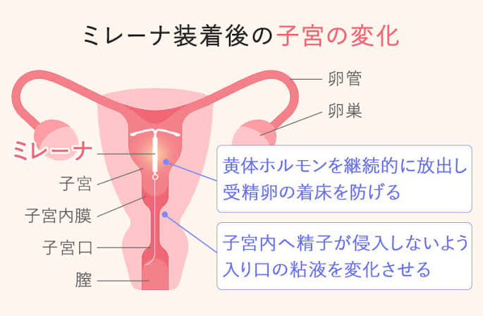 思い切ってやって良かったこと、これからやりたいこと