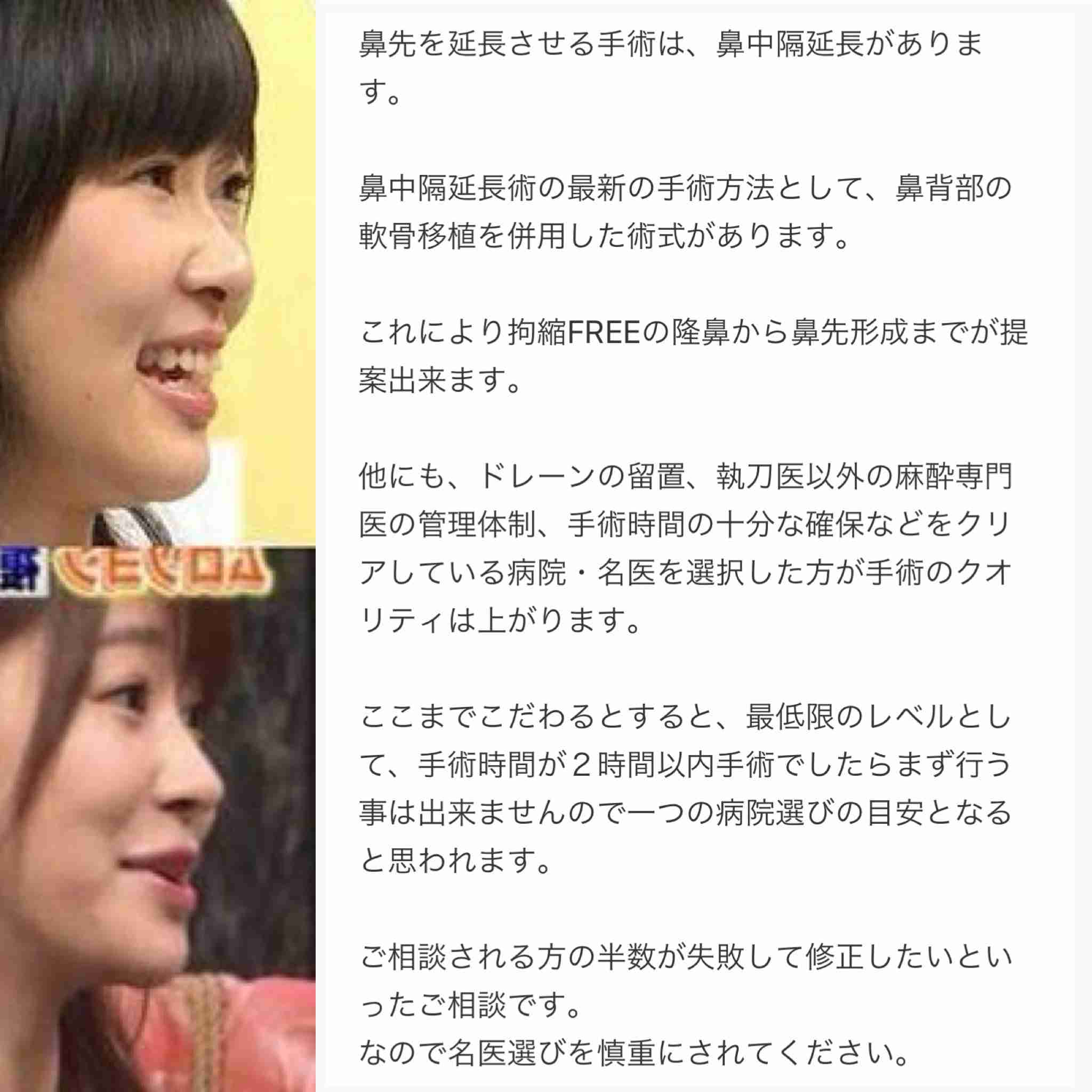 指原莉乃、美容のヒミツ大公開 コスメ付ムック本発売「かわいくなる情報シェアできたら」