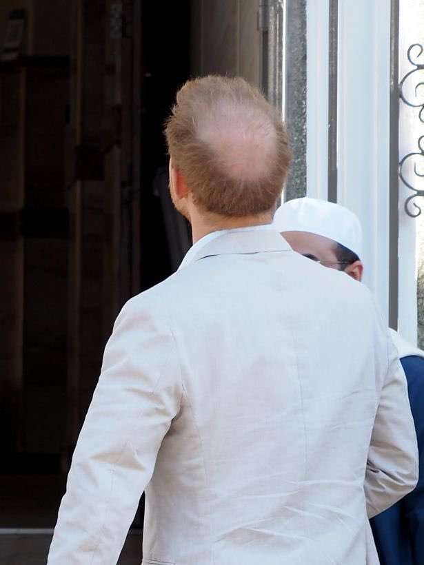 メーガン妃「英王室、長男の肌の色の濃さを懸念」明かす