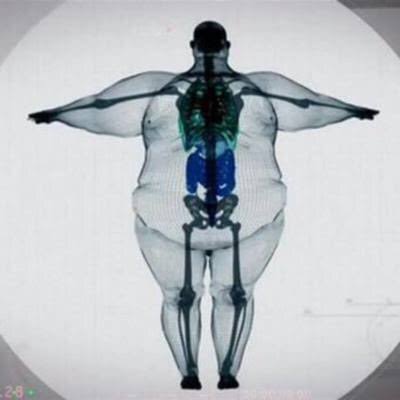 【閲覧注意かも】衝撃を受けた画像を貼るトピPart2