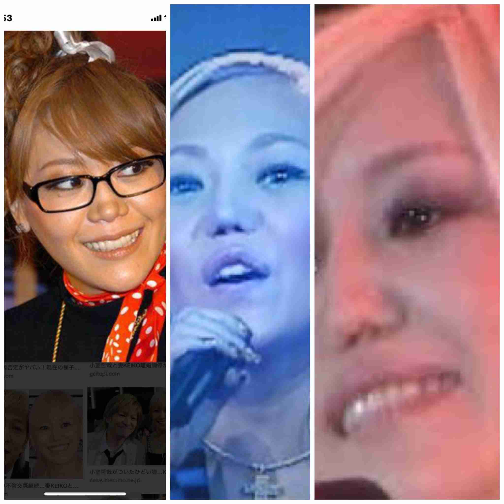 小室哲哉「協力したい」KEIKOへまさかの再プロデュース提案