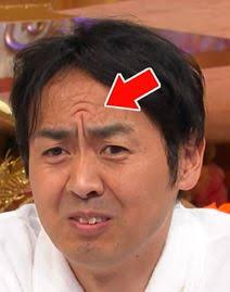 眉間のシワ