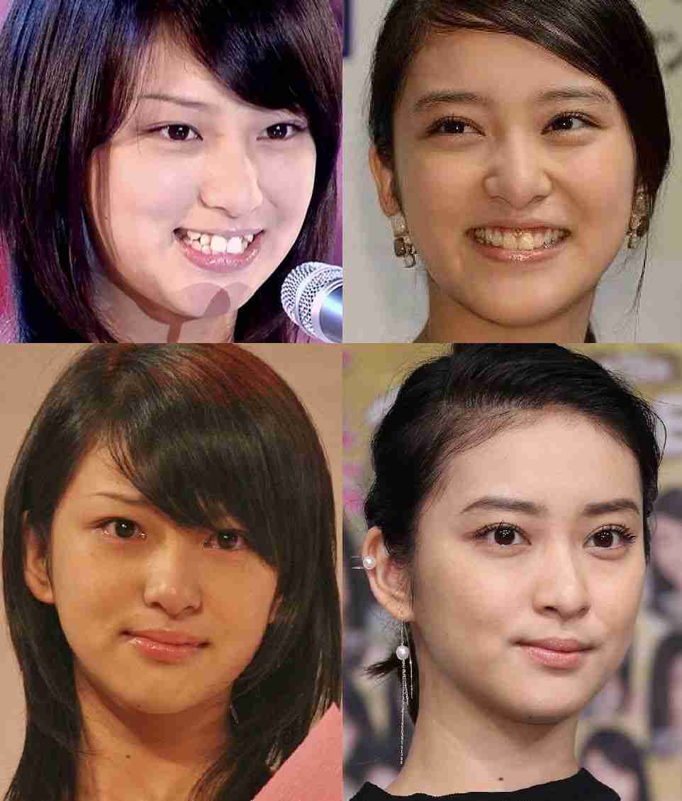 整形していない有名人