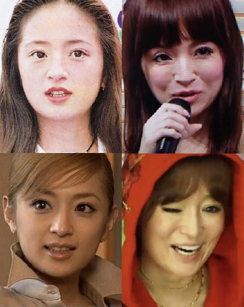整形していない有名人