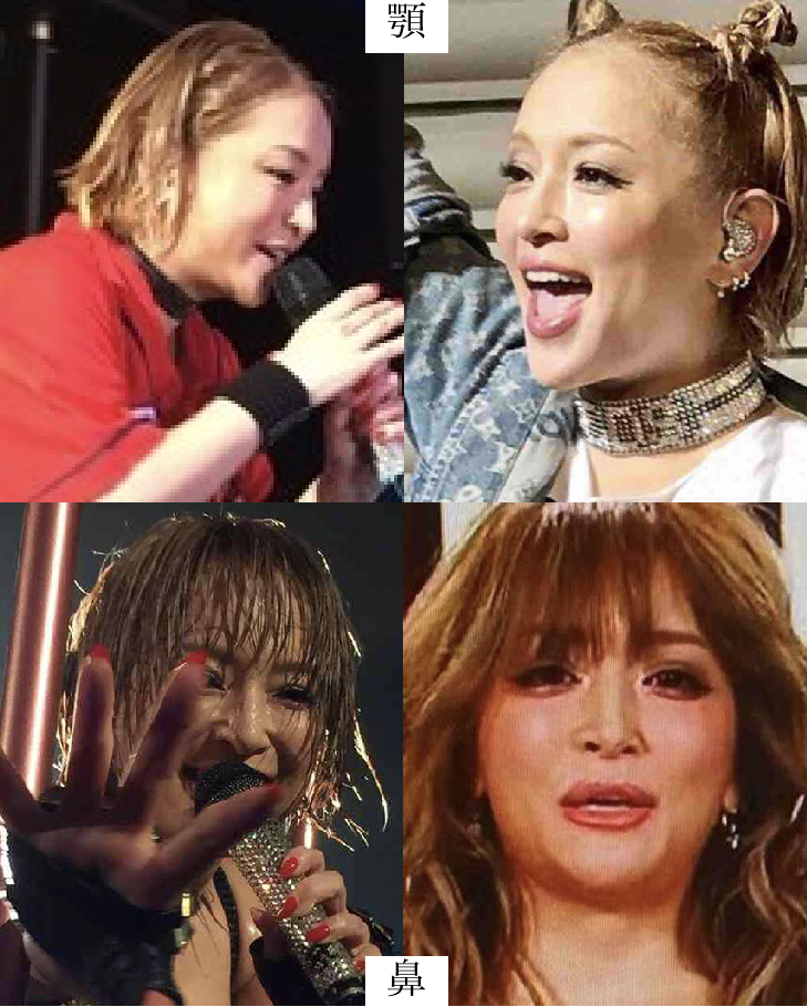 整形していない有名人