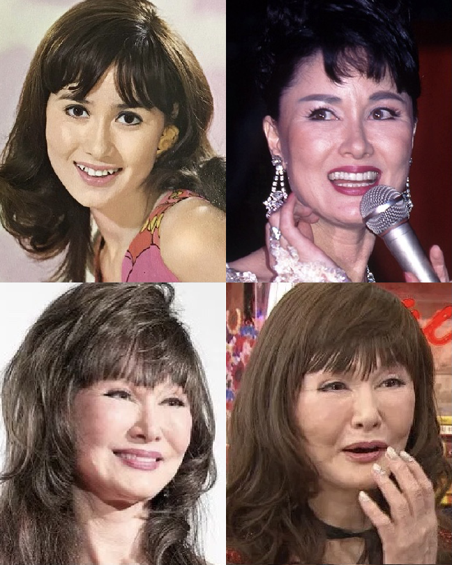 整形していない有名人