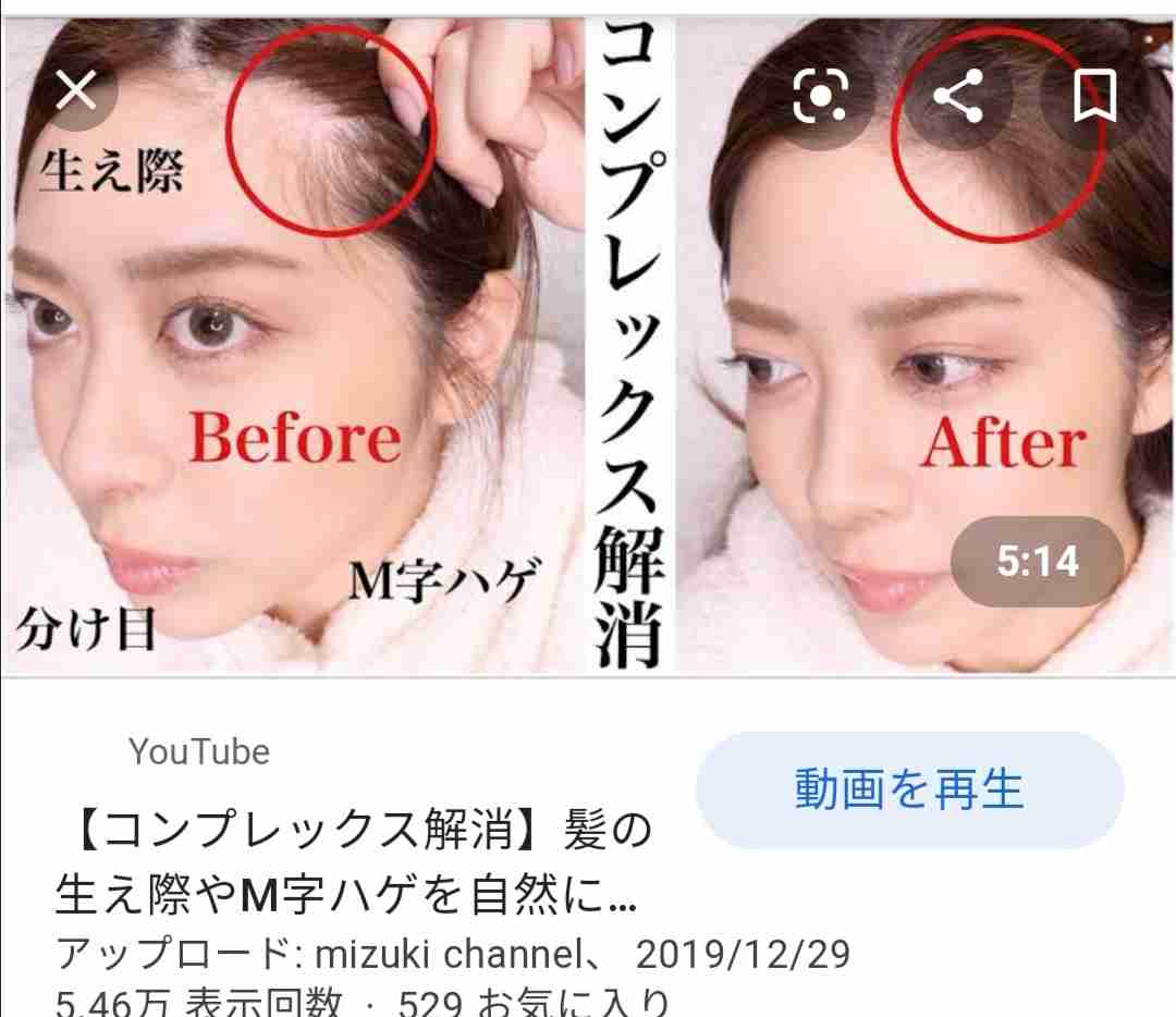 【うなじ】ナチュラル派?脱毛派?