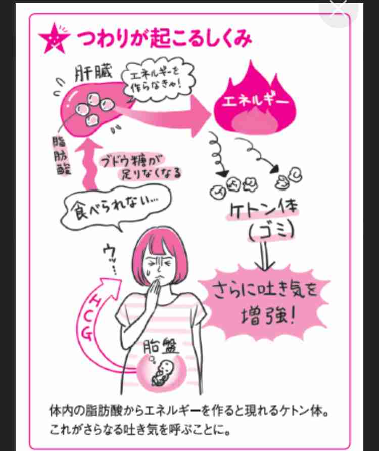 【原因】悪阻について話そう【不明】