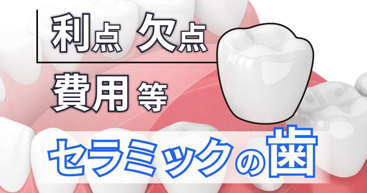 セラミックの歯について語りたい