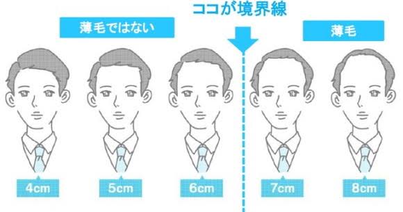 何でこんなに個人差があるんだろうと思うもの