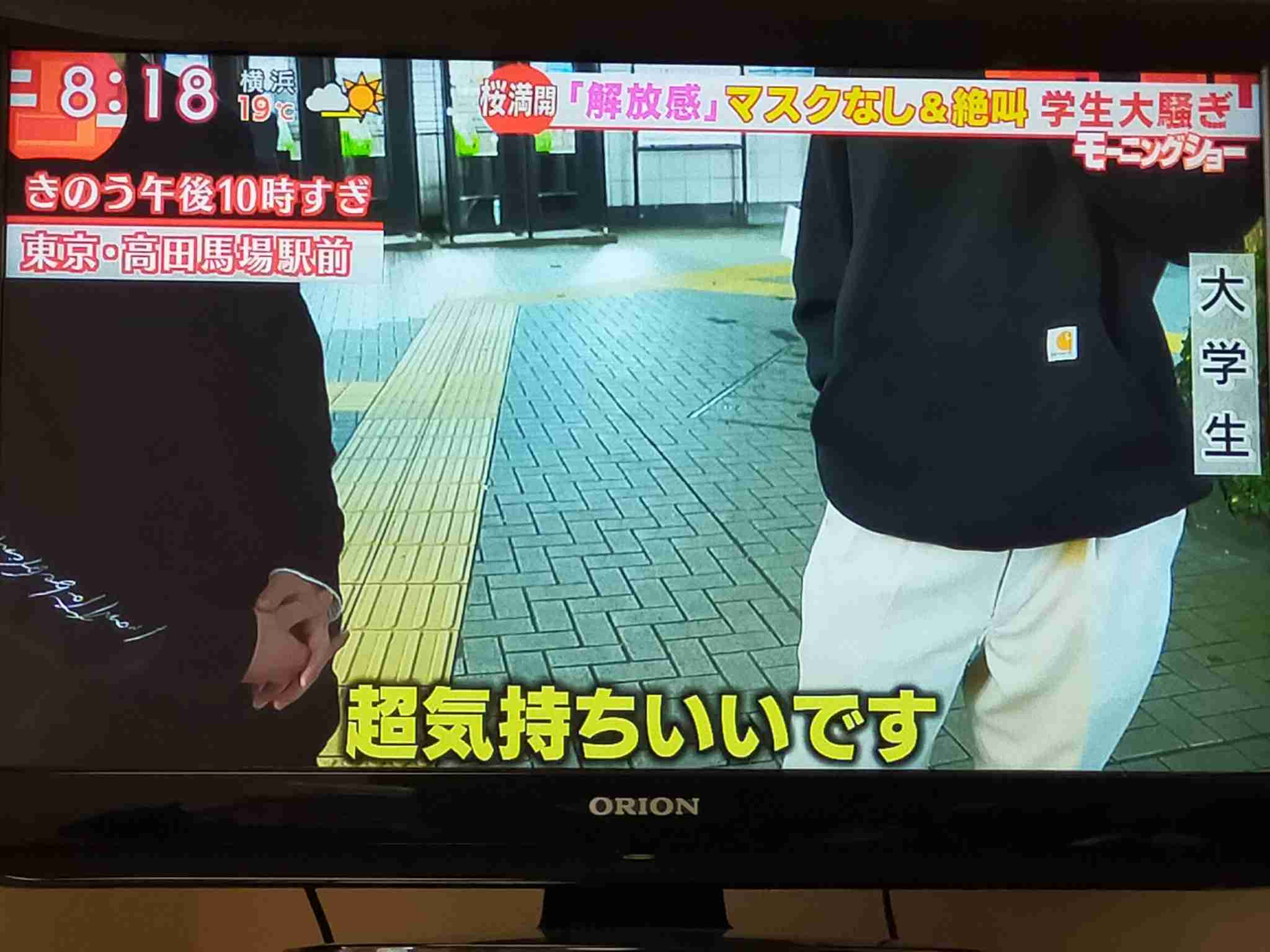 友人の髪に大量の整髪剤つけライターで点火…火傷で重傷負わせる 大学生の男を逮捕