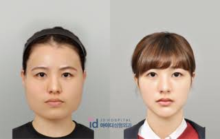 💆‍♀️とにかく顔が大きいガル民集合！！パート2