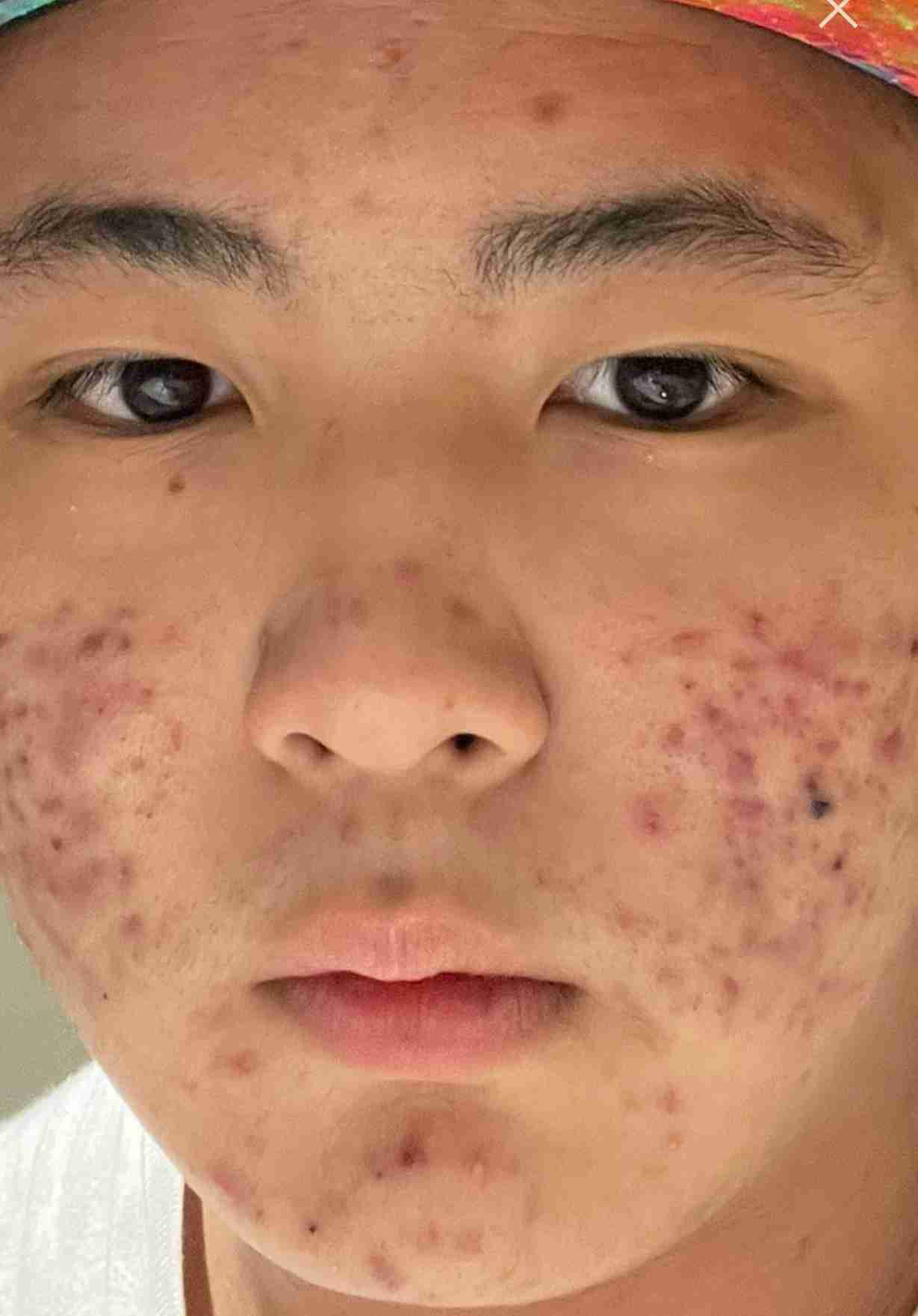 木下博勝医師、終業式の朝にブルーヘアのポニーテール＆ゴツめネックレスをした長男・大維志くんを公開「カッコいい」