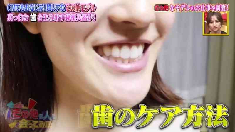 歯の治療いくらかかりましたか?Part2