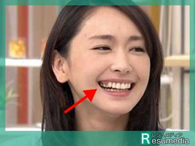 歯の治療いくらかかりましたか?Part2