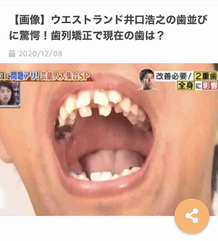 歯の治療いくらかかりましたか?Part2