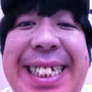 歯の治療いくらかかりましたか?Part2