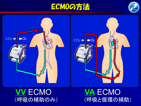 「重症化スピードが非常に早い」大阪の新型コロナ、感染歯止めかからず…“不急の手術”延期要請に現場医師の声