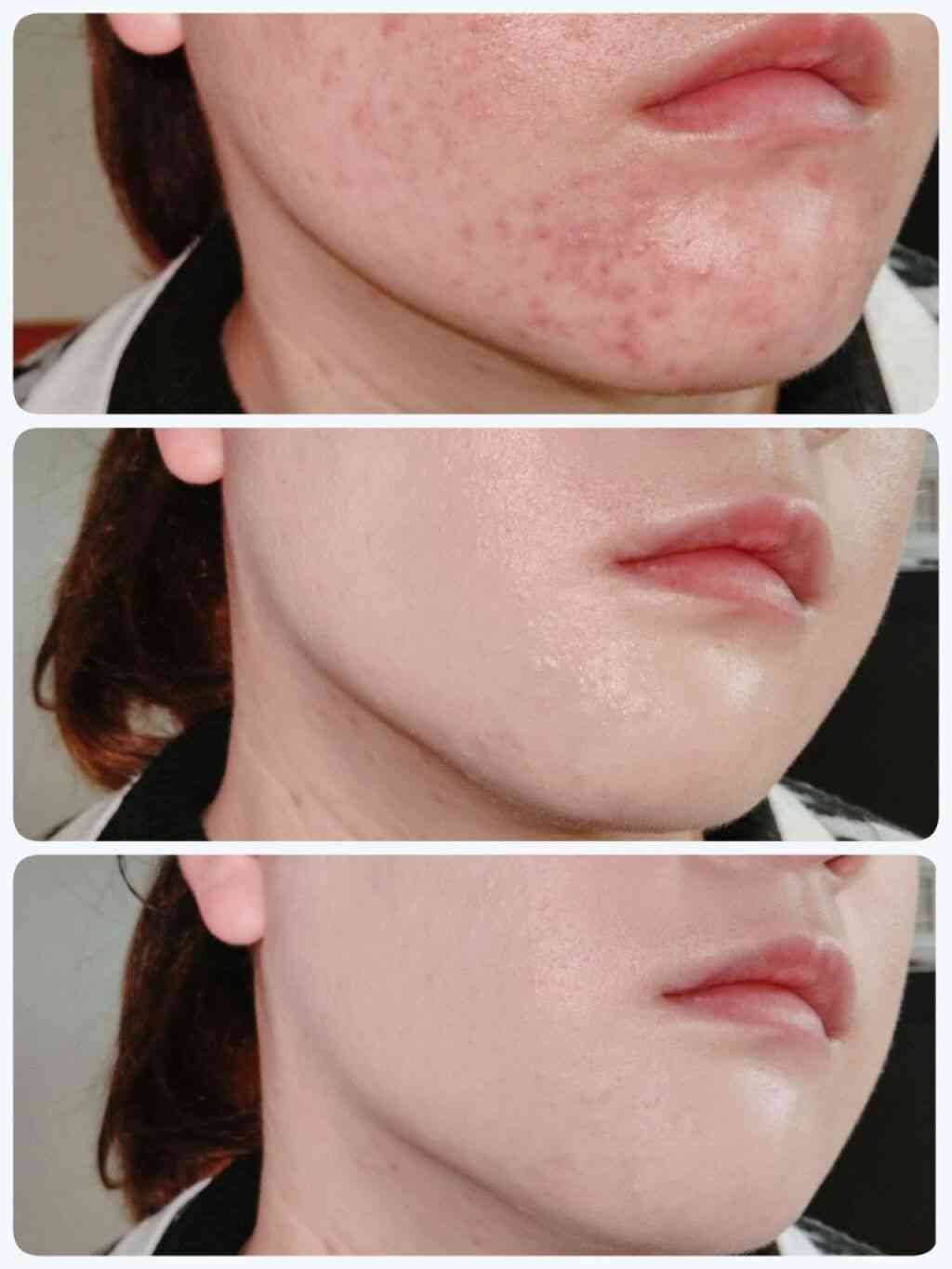 カバー力のあるファンデーション