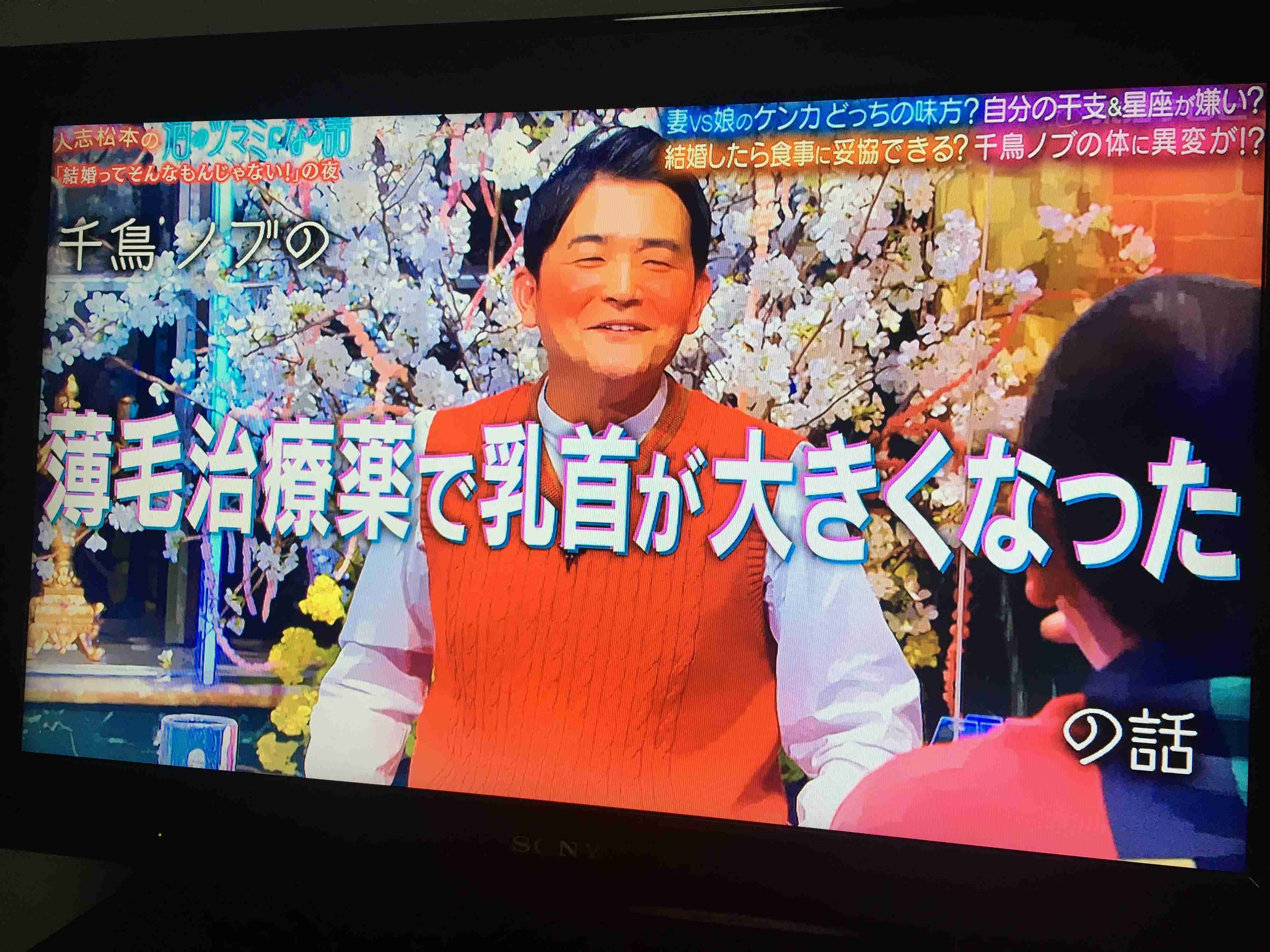 千鳥ノブ、薄毛治療薬で“女性化”始まりボヤキ節