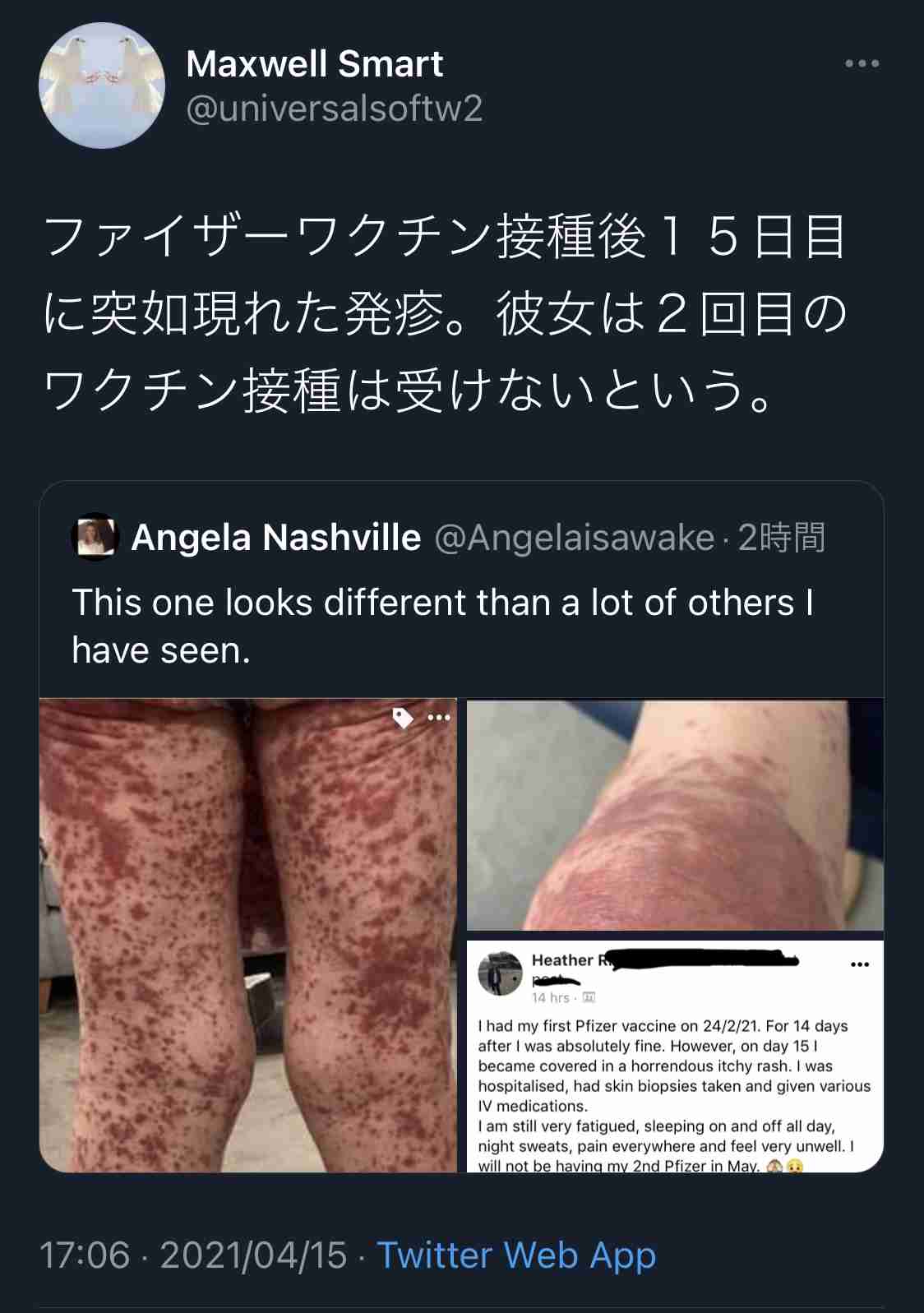 Twitter、「クラブハウス」買収で一時交渉　米報道