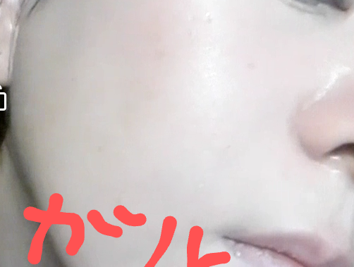 毛穴改善トピ