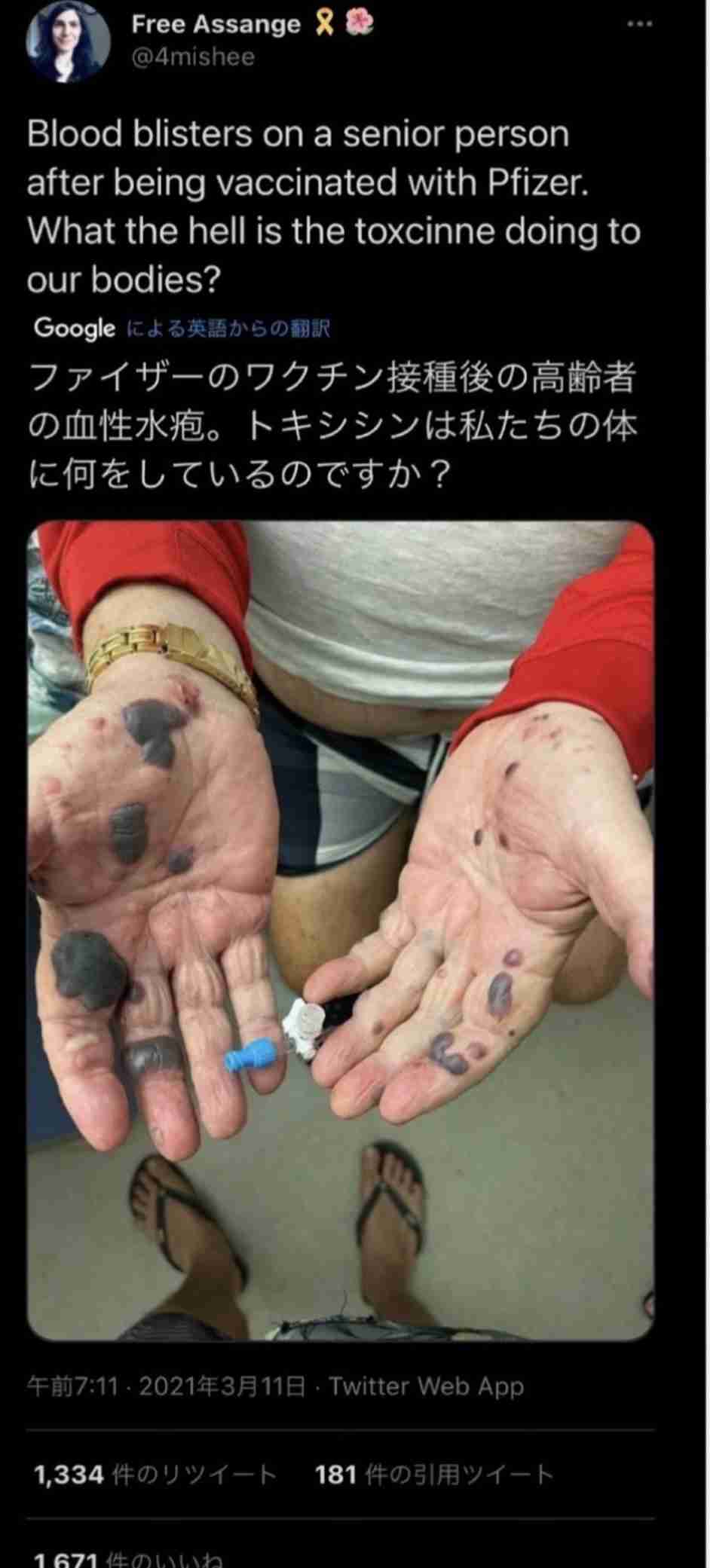 医療従事者のみなさん、ワクチン受けましたか？