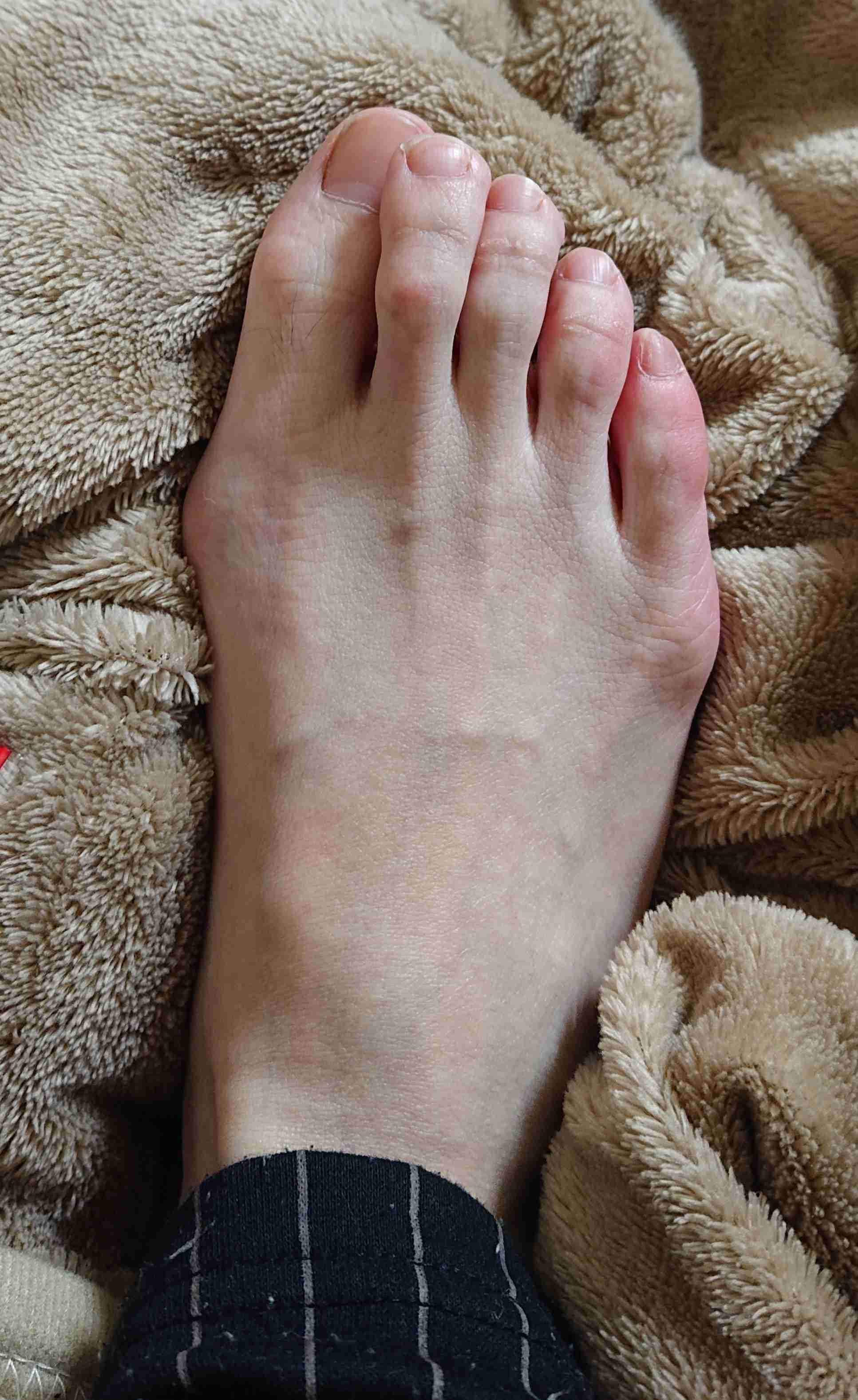 開張足（かいちょうそく）の人 ガールズちゃんねる Girls Channel