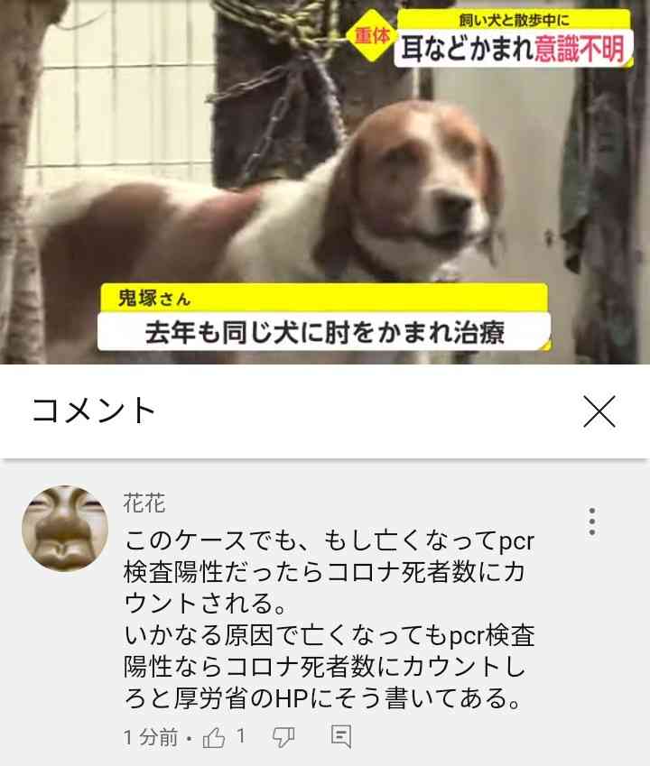 飼い犬にかまれ　男性が意識不明の重体　薩摩川内市・鹿児島