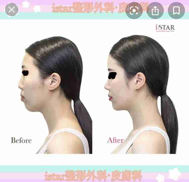 横顔が超ブサい