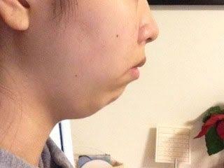 横顔が超ブサい