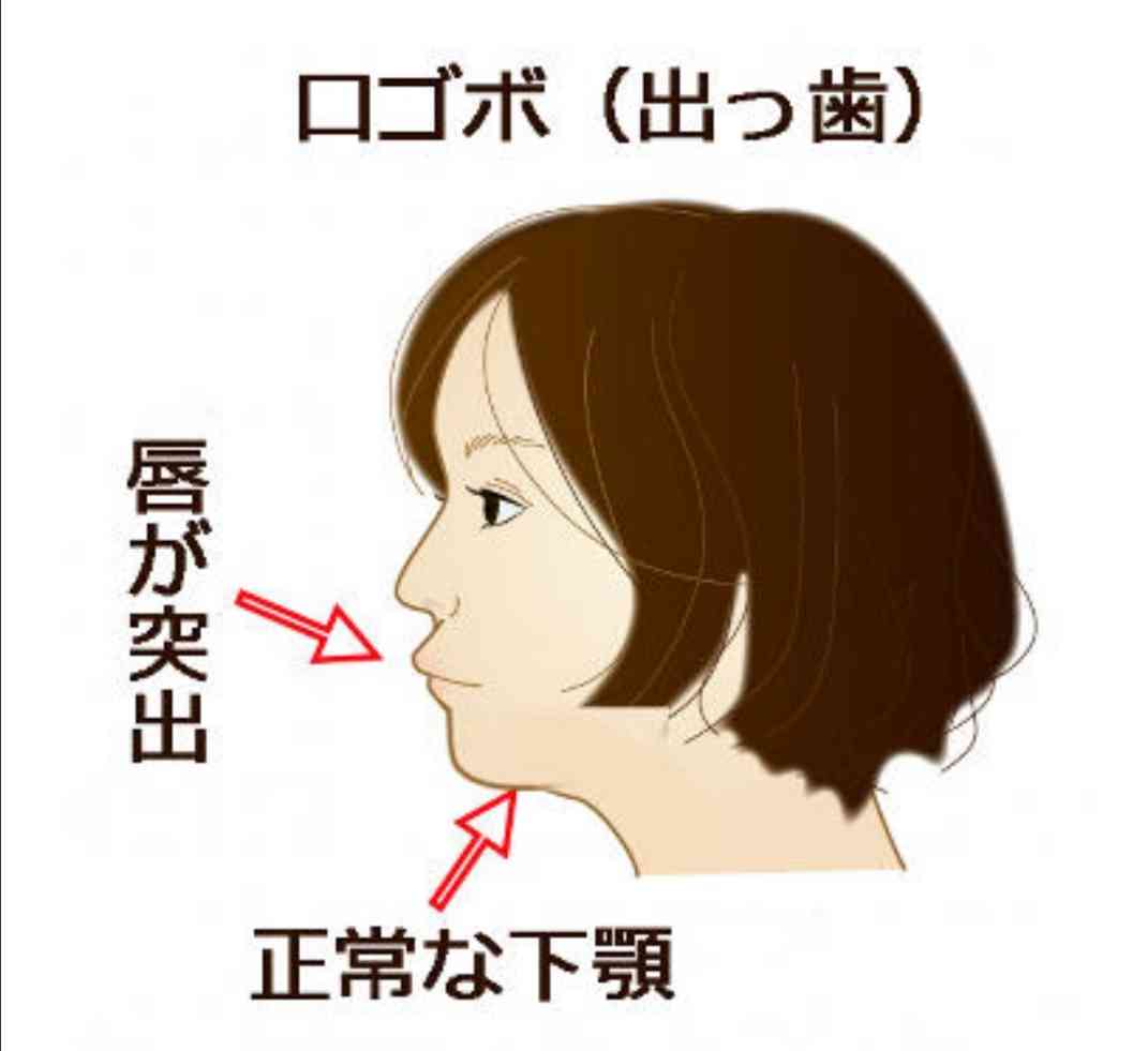 横顔が超ブサい