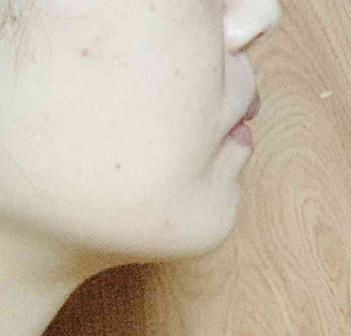 横顔が超ブサい