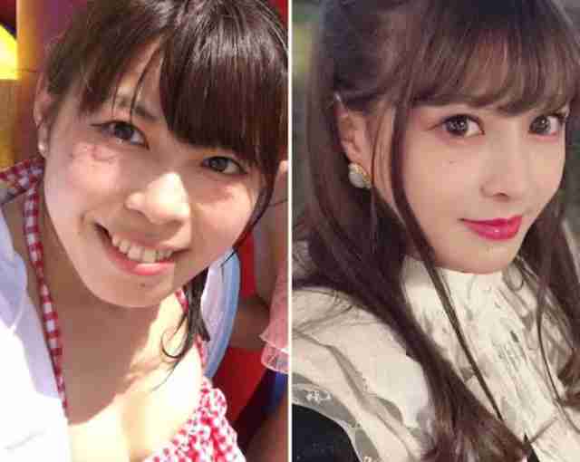 美容整形の怖い話Part2