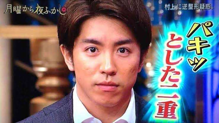 自力で一重瞼から二重になった人いますか?