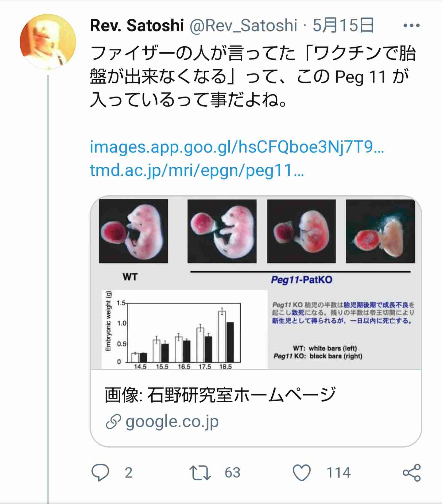 アストラゼネカ製のワクチンを「処分」フランス医師が苦渋の決断