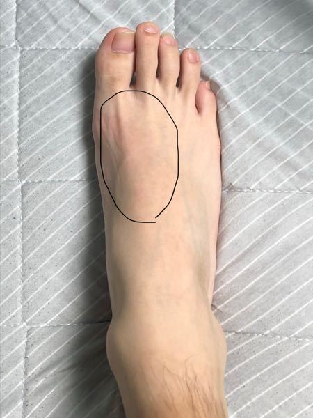毛深い人集合!