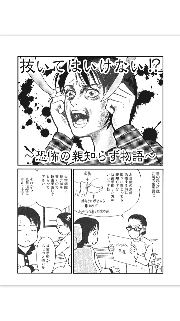 親知らずを抜いた後のトラブル