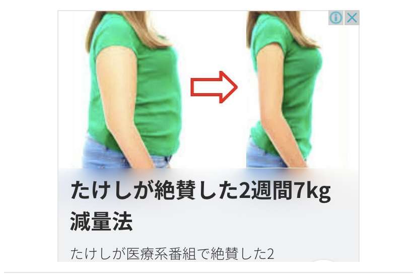 太ももが太い!細くなりたい!