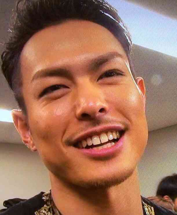 すきっ歯の治療したことある人