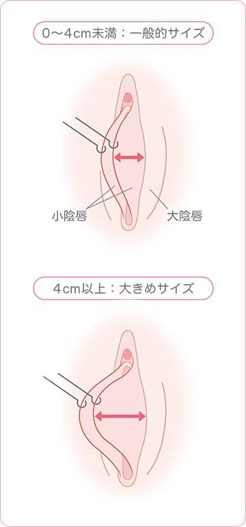 ［アダルト注意］人には言えない体や性の悩み