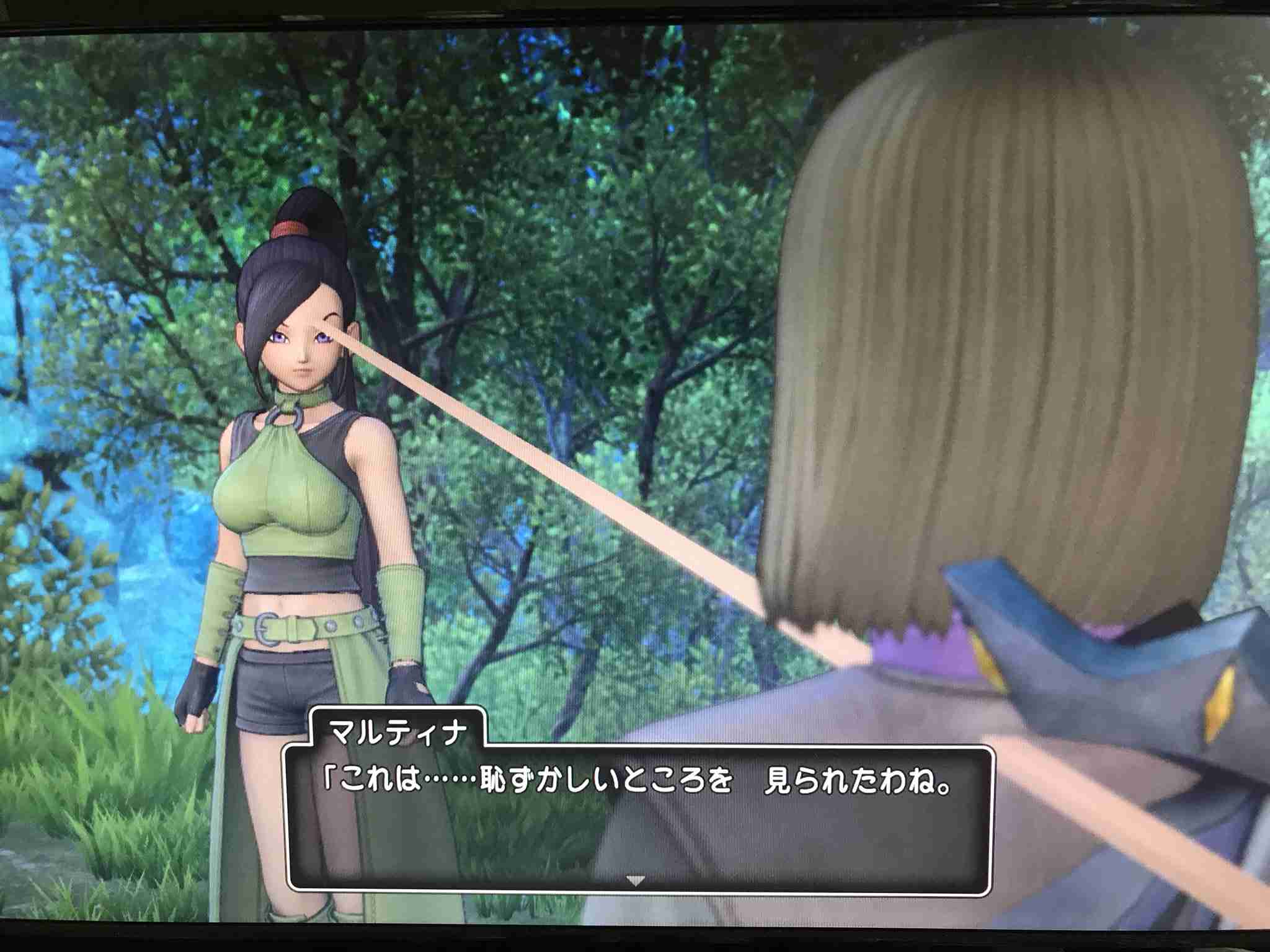 ゲームのバグ画像が見たい