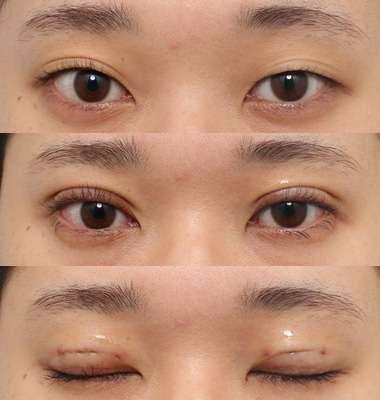 奥二重・一重の美人が見たい　part4(芸能人限定)
