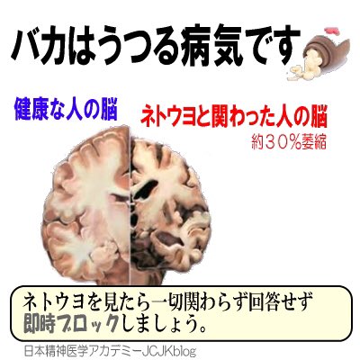 笑われて心外だったこと
