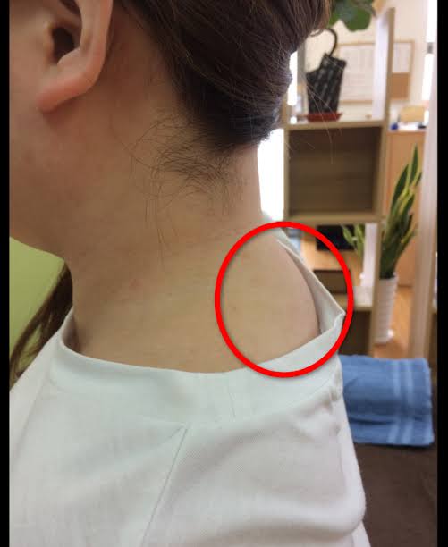 背中がおばさんくさい！