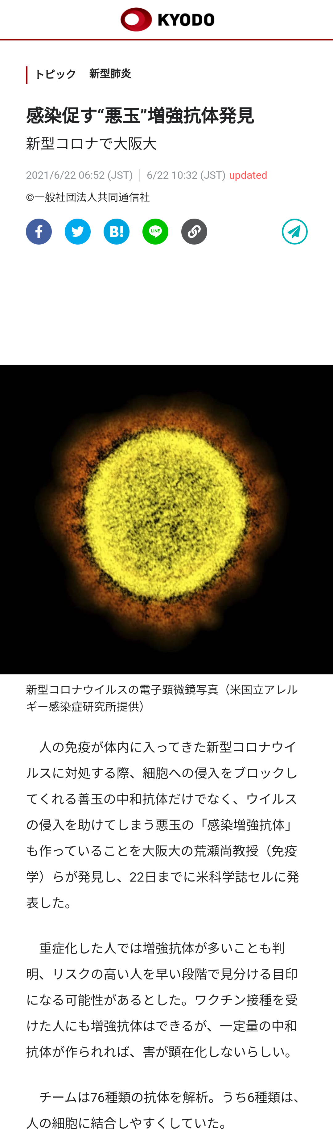 東京都で新たに435人の感染確認 先週火曜より98人増 重症者は2人減の45人