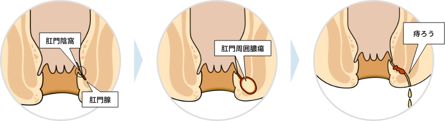 今まで酷かった病気や怪我は？